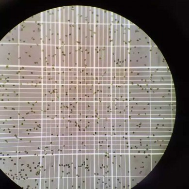 利用血球计数板计算藻细胞密度数量